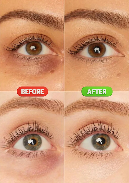Hydreva™- Hydrogel Eye Patch